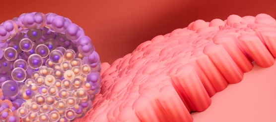 La edad del endometrio más allá de la euploidía embrionaria