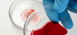 Estudio exploratorio sobre sangre menstrual como fuente diagnóstica y terapéutica
