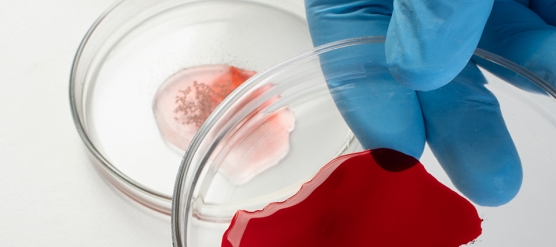 Estudio exploratorio sobre sangre menstrual como fuente diagnóstica y terapéutica