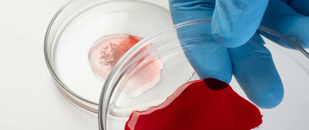 Estudio exploratorio sobre sangre menstrual como fuente diagnóstica y terapéutica