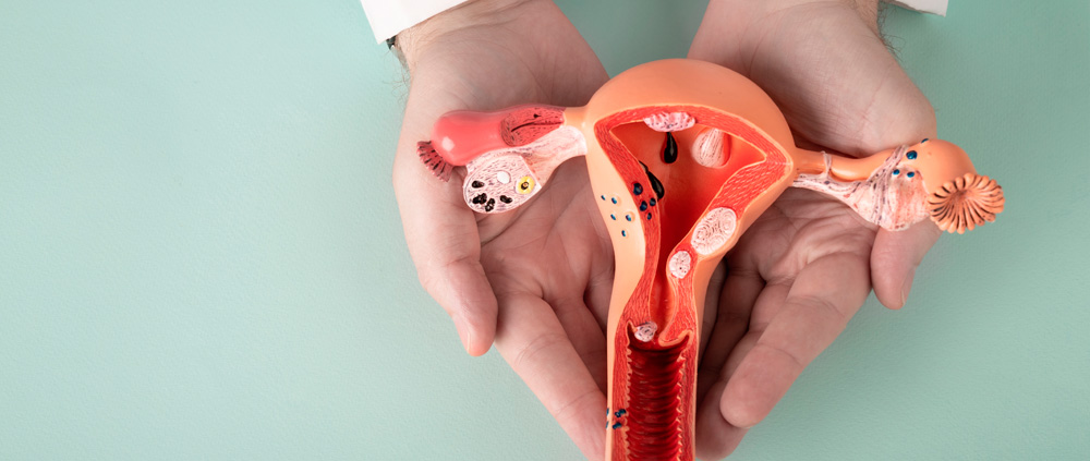 Síndrome de Ovario Poliquístico (SOP): una condición frecuente y no siempre diagnosticada